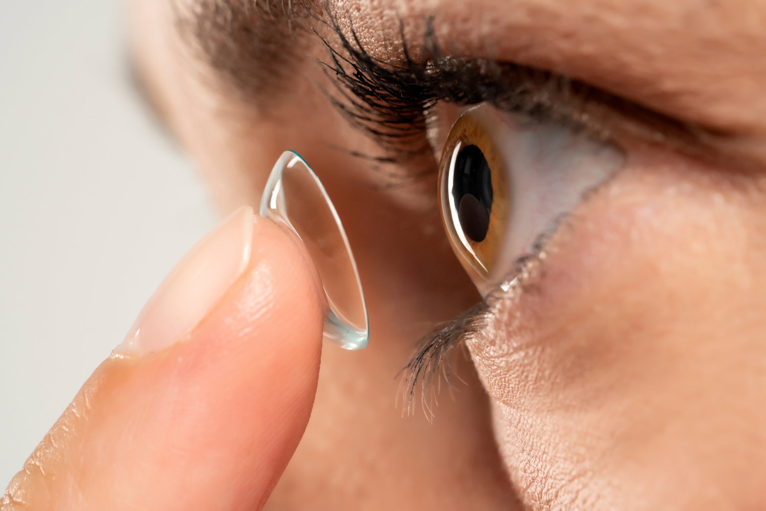 Das Bild zeigt einen Finger, der eine Linse in ein Auge einsetzt.